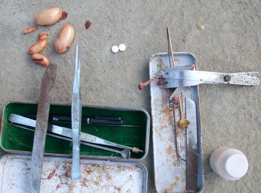 传统阉鸡技术教程视频,古老的阉鸡技术