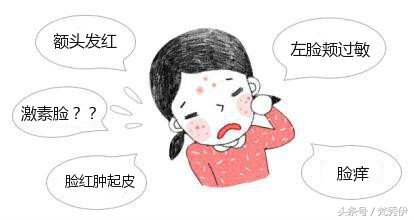 辨别激素脸方法有哪些,激素脸的分辨