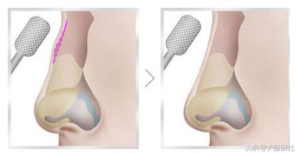 甜美公主养成记,甜妹养成记