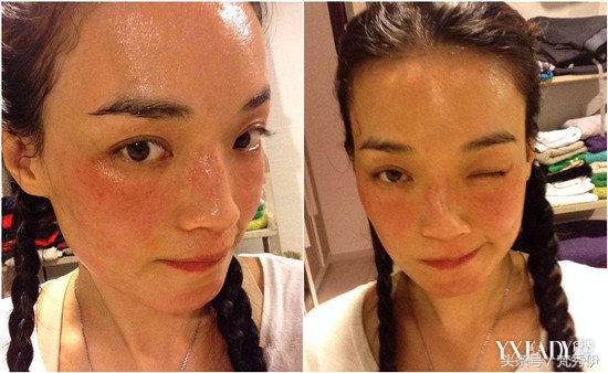 告别敏感肌的困扰让皮肤恢复原状,告别敏感脆弱皮肤