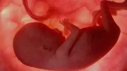 流产和宫外孕哪个可怕,流产跟怀孕有什么关系