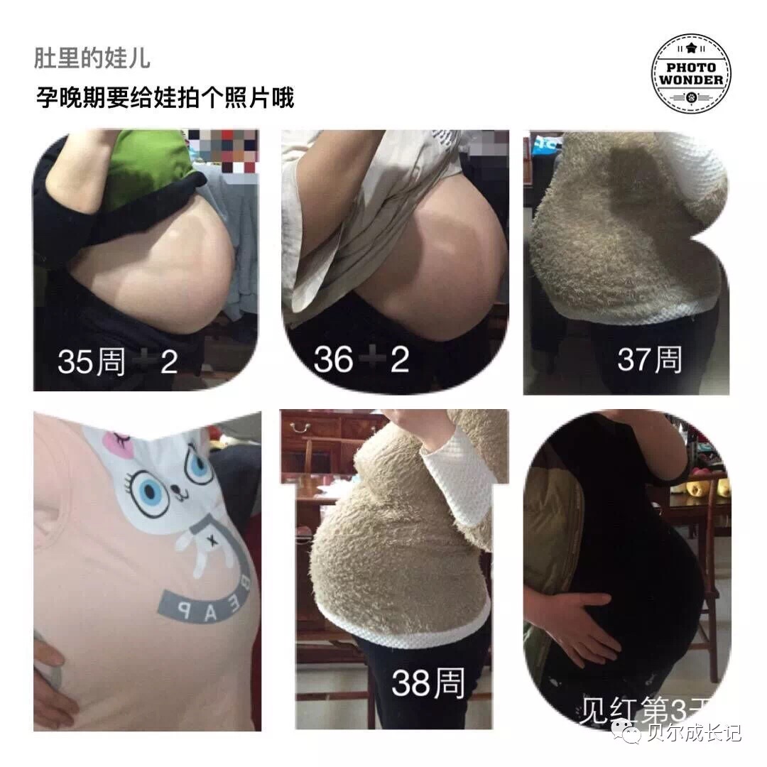 孕19周该做什么检查,正确推测孕周方法