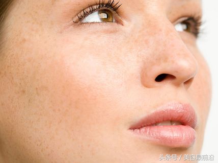去掉脸上麻雀斑的方法,如何去掉脸上的雀斑呢