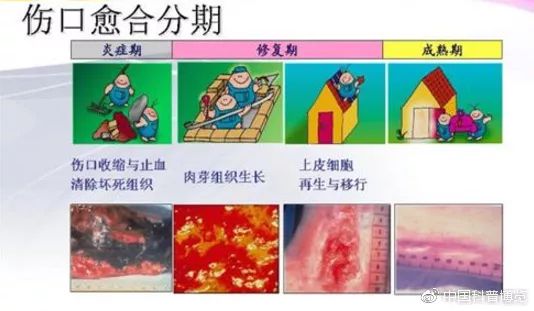 辟谣：术后忌口？别再被“发物”吓到了