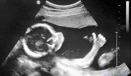 x光ct和核磁共振b超的区别,x光ct磁共振b超有什么区别