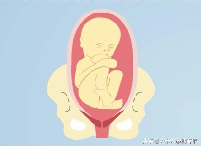 胎位不正婆婆让顺产,胎位不正还能顺产么动画演示