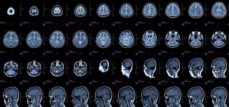 x光ct和核磁共振b超的区别,x光ct磁共振b超有什么区别