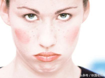 红血丝用激光能去掉吗,红血丝可以用激光去掉吗