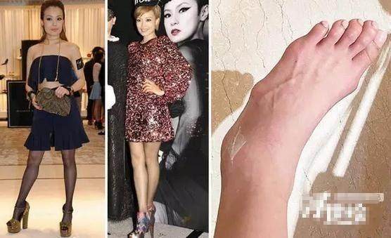 杨丞琳用黑绷带,杨丞琳安慰粉丝视频