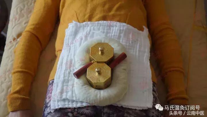 艾灸后可能出现的妇科排毒反应,艾灸膻中穴排病反应及处理方法