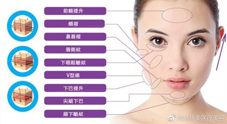 线雕的优势,线雕的效果