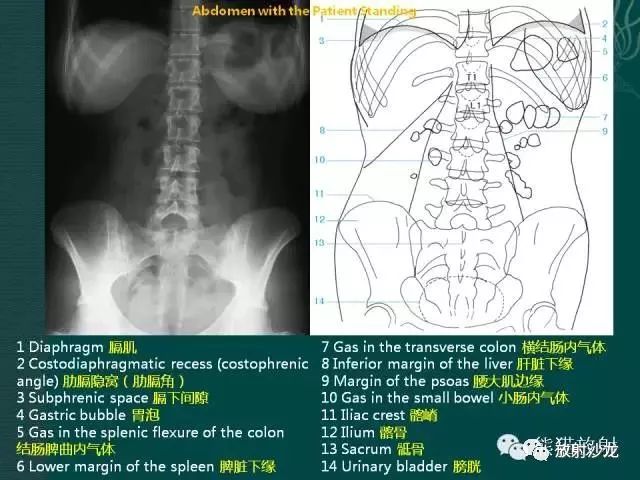 详细腹部平片解剖+正常表现+读片技巧+病例分析