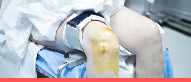 什么叫关节镜手术,关节镜手术后可以评几级伤残