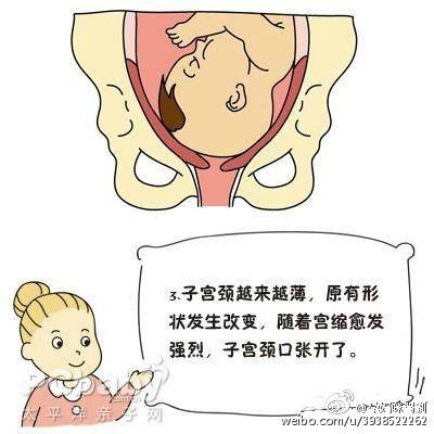 分娩子宫峡部变化,子宫颈细胞变化