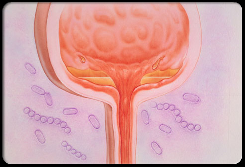 盆腔疼痛怎么引起的,盆腔疼痛是什么原因引起的