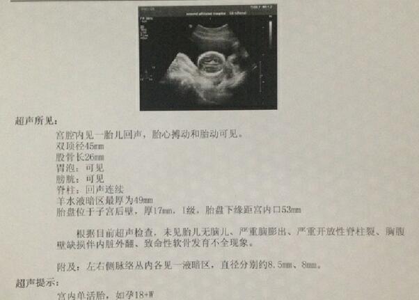 科普100张图看懂怀孕,一张图说明生小孩有多痛苦