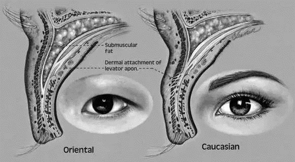 哭多了会不会死,哭会把双眼皮哭成单眼皮吗