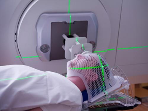 放疗治疗范围有哪些,放疗主要针对的病