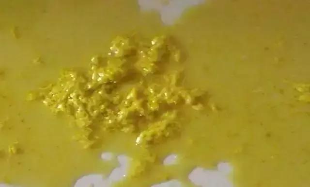 绿色便和黄色便的原因,黑绿色稀便是什么原因