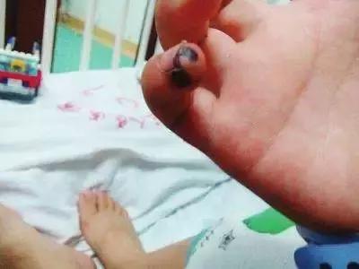 幼儿园常见意外伤害急救处理方法,幼儿园意外伤害的预防及急救