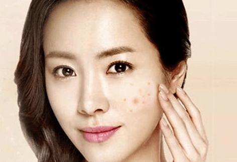 脸上激素依赖性皮炎正确治疗方法,激素依赖性皮炎有哪些忌口