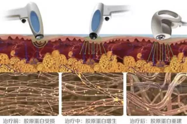 温碧霞同学照片,温碧霞和同学的差距