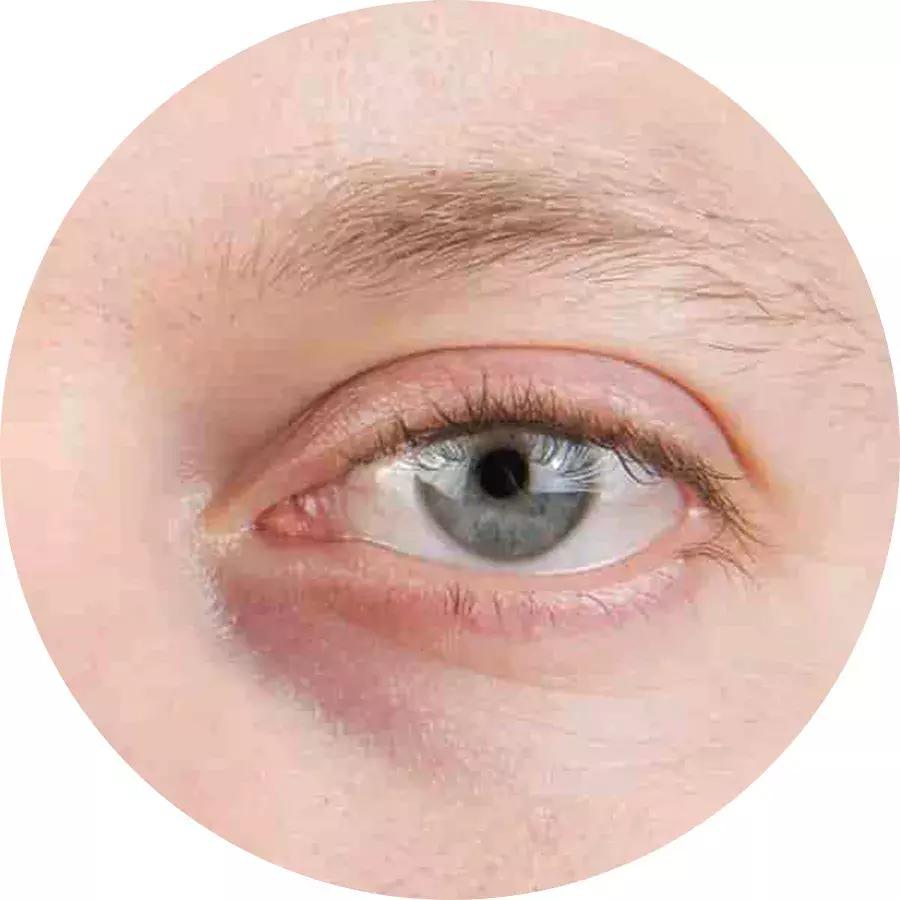 眼霜也要到年纪了才用,眼霜多大岁数适合用