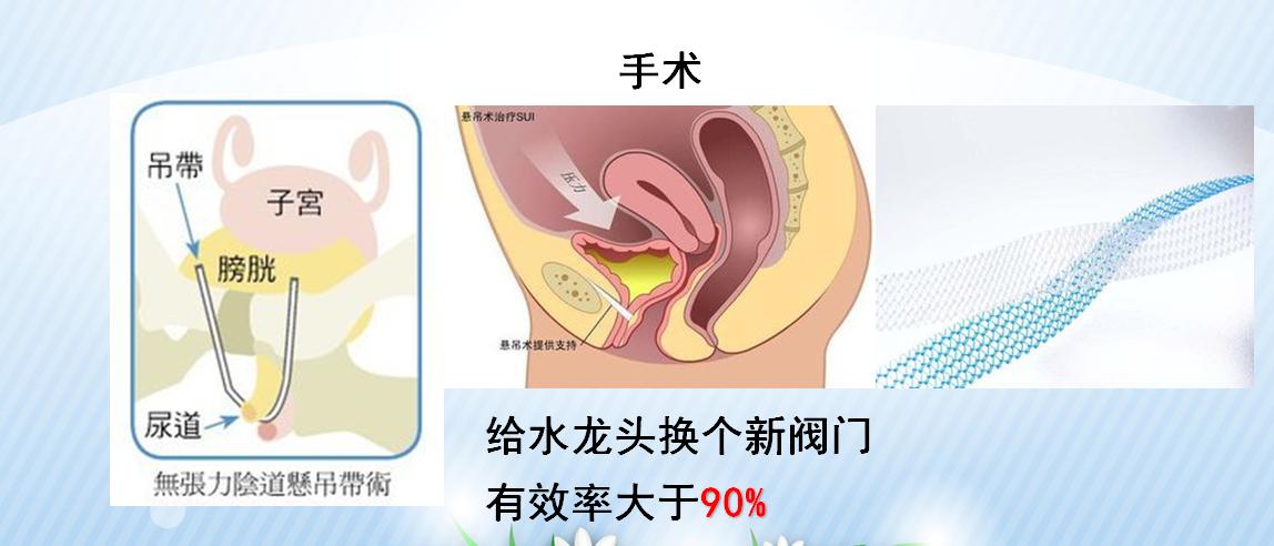 咳嗽大笑有尿漏出是什么原因,咳嗽大笑漏尿怎么治