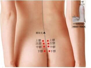 前列腺炎艾灸多久可以治愈,前列腺炎艾灸好还针灸好