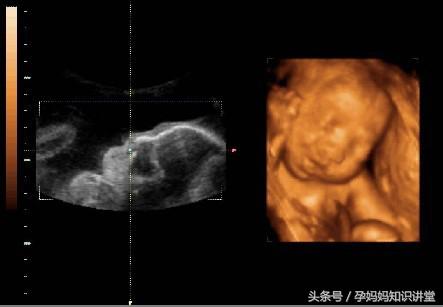 36周婴儿肺部发育差点问题大吗,婴儿发育标准对照表0到36个月