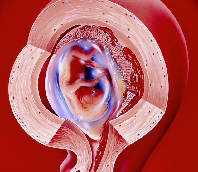 就医搜｜流产后难怀孕？别让流产为你的健康埋下“定时*弹炸**”！