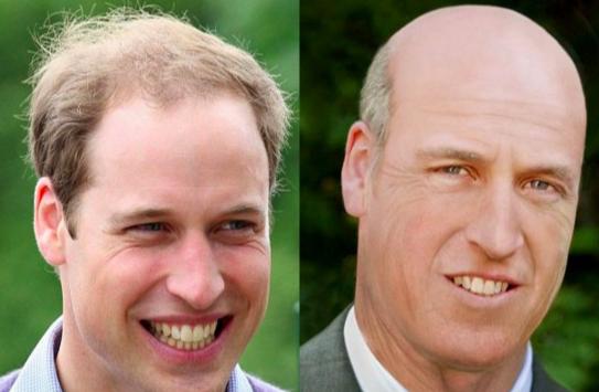 睫毛增长液和孕睫术,睫毛孕睫术能重复做吗