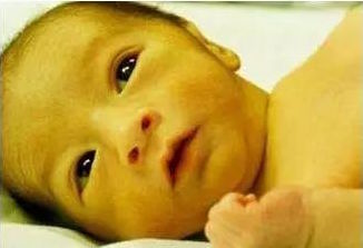 新生宝宝越来越黄,刚出生的宝宝变黄是怎么回事