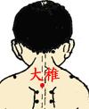 小儿肺炎发烧推拿手法,武汉极鹤小儿推拿
