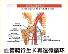 股骨头坏死该如何治疗？给你这三个建议！