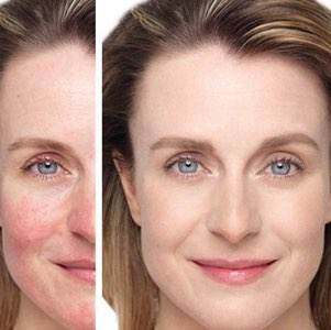 想要肌肤水嫩,混合肌肤用什么乳液最好