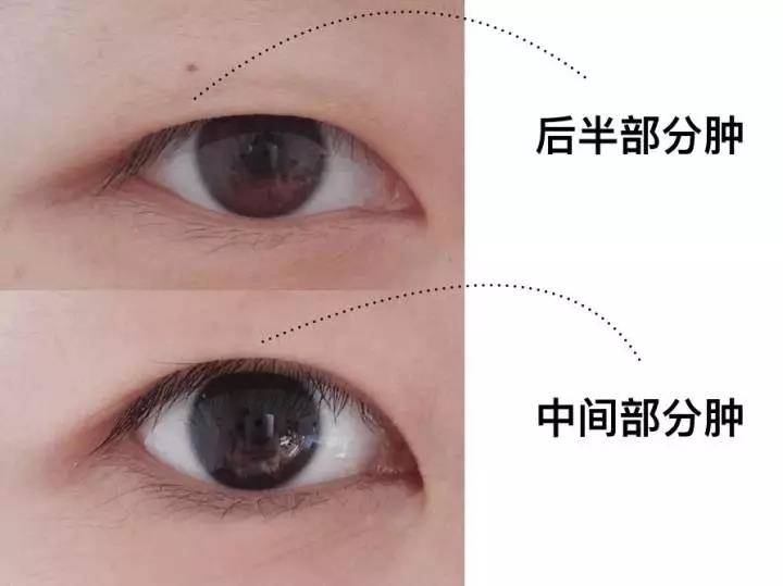 肿内双眼皮怎么画眼妆,肿泡眼内双怎么画眼妆