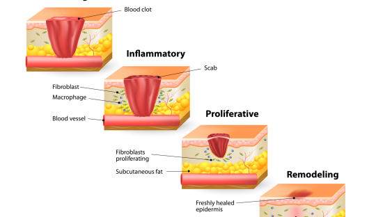 怀孕期间剖腹产伤口痒是怎么回事,剖宫产怀孕后伤口刺痛怎么办