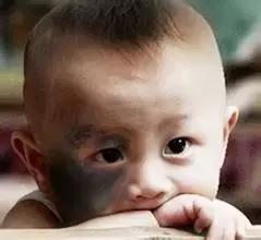 每个人是不是都有痣,每个人都必须有痣吗