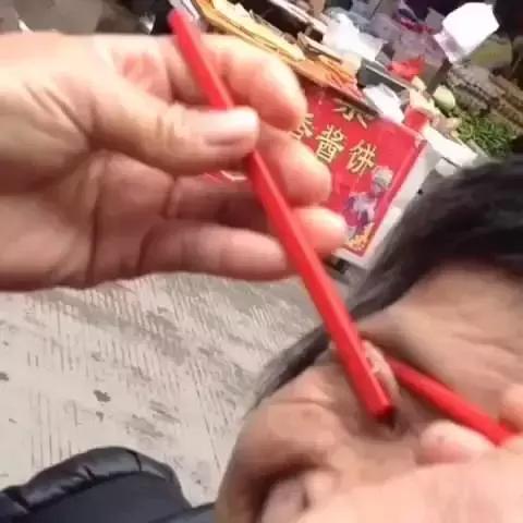 路边上有人抓眼虫是真的吗,用筷子真可以捉眼虫吗