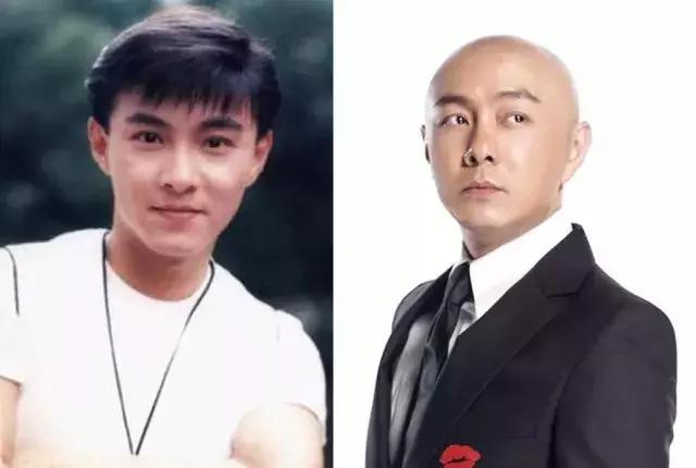 发际线不好看怎么剪,如何拯救90后的发际线