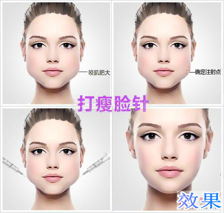 国家认可瘦脸针,军医扎针