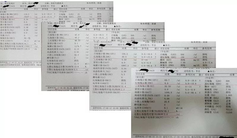 高压氧舱治疗膀胱炎尿血吗,高压氧对慢性肾病有作用吗