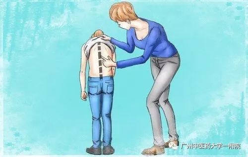 脊柱侧弯属于严重残疾吗,儿童脊柱侧弯去哪个医院好