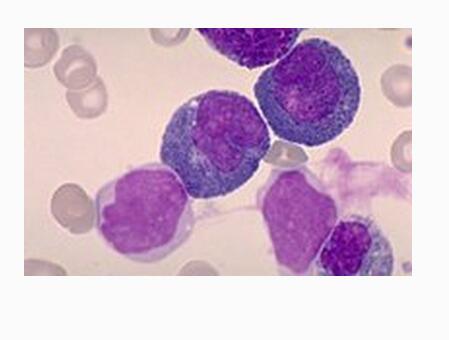 从怀孕到分娩必要检查项目和费用,分娩前大检查项目