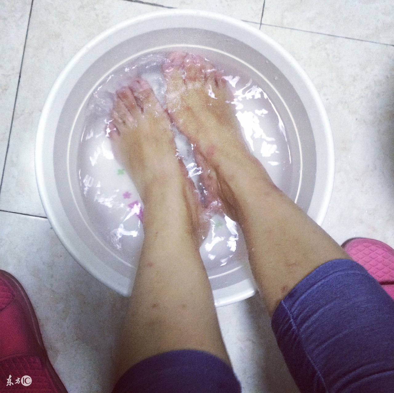 发烧感冒头疼怎么缓解,感冒发烧38.5算严重吗要去医院吗