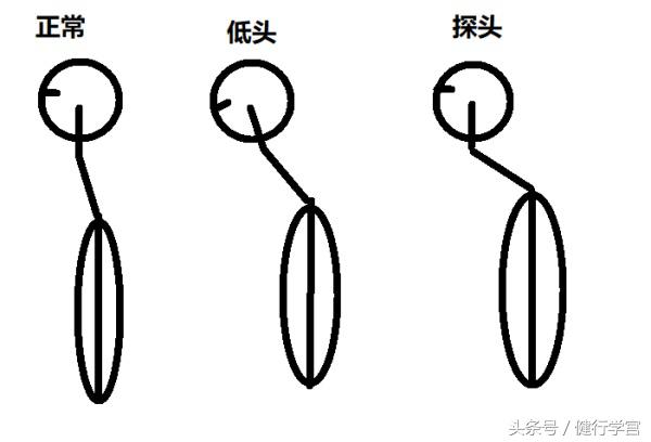 颈椎病的康复治疗手法,颈椎病用圆枕能康复吗