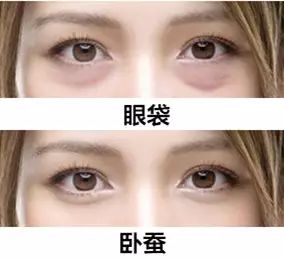 眼袋显老还是泪沟显老,40岁眼袋有泪沟怎么办
