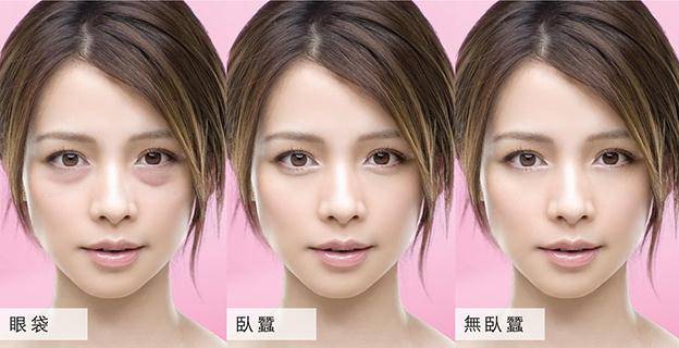 眼袋显老还是泪沟显老,40岁眼袋有泪沟怎么办