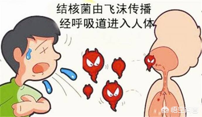 为什么从来没有感染过结核，也会出现结核菌素阳性